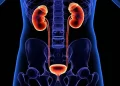 University of Ghana Study Links West African Gene Variant to Higher Kidney Disease Risk.