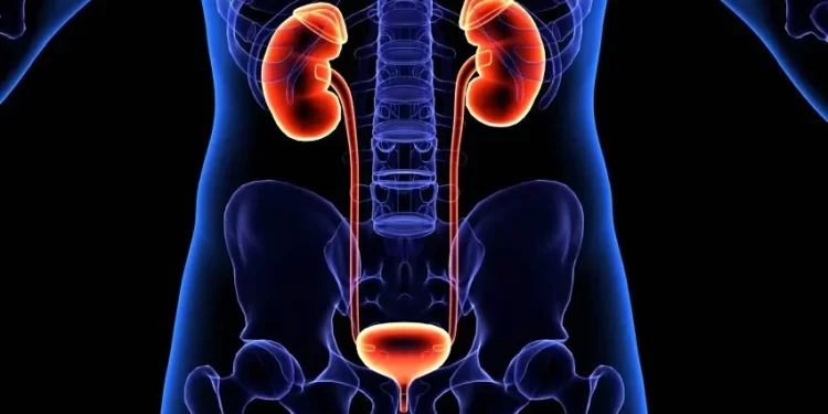 University of Ghana Study Links West African Gene Variant to Higher Kidney Disease Risk.